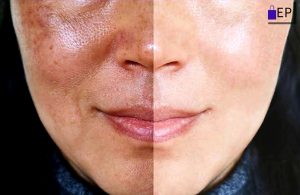 Vaseline Healthy Even Tone Before And After
